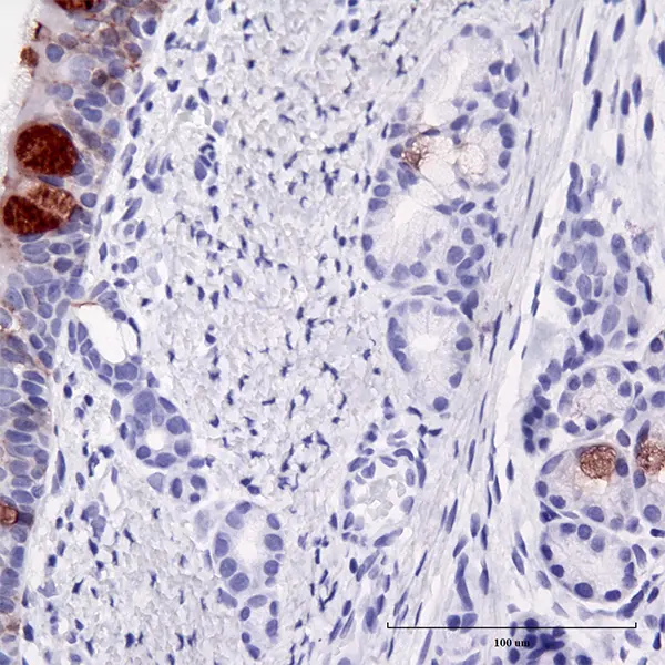 M-cells in Porcine trachea